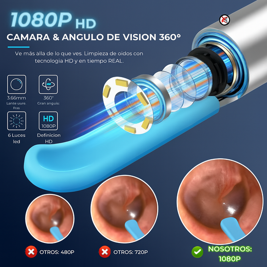 Limpiador Inteligente de Oídos con Cámara HD 360° | Conexión WiFi y Luz LED